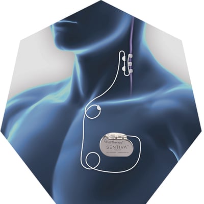 vns-therapy-placement