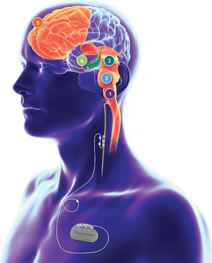 3D cut-away illustration of human body showing components of the brains